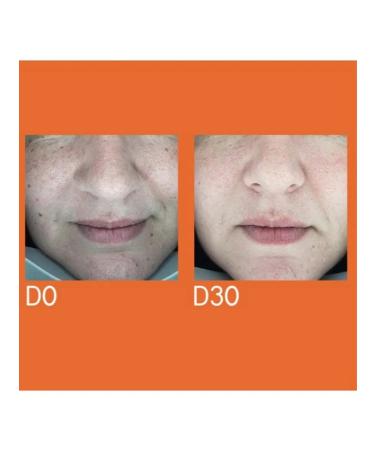 YOUTH LAB Serum for removing dark spots 30ml - Buy Online on GoSupps.com