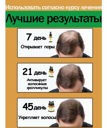 LYDIMOON Hair growth serum breaking the loss and baldness - Buy Online on GoSupps.com