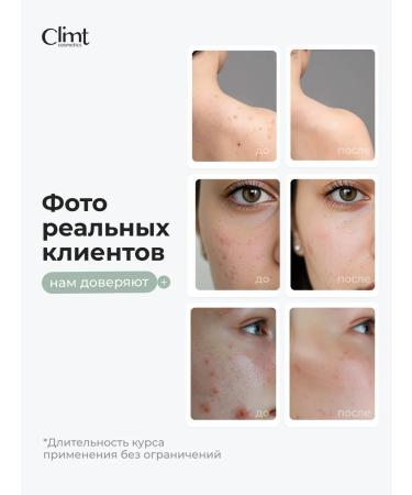 CLIMTCOSMETICS Poppy acne with niacinamide for narrowing pores - Buy Online on GoSupps.com