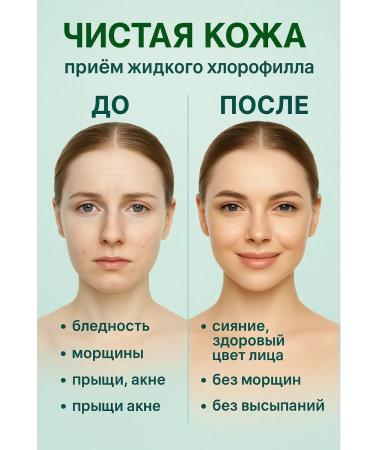 Alantra Liquid chlorophyll Witgrasses with aloe vera 1000ml - Buy Online on GoSupps.com