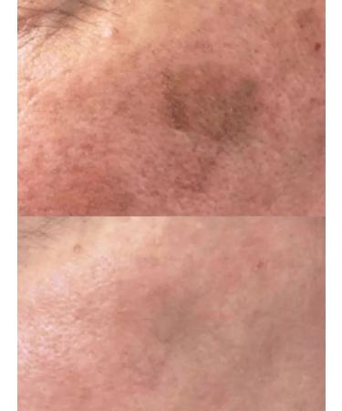 Fusion Mesotherapy F-Melaclear facelless facial serum 10 ml - Buy Online on GoSupps.com