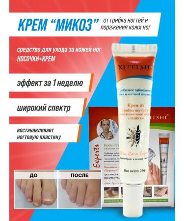 INDD1 Nail fungus cream mycosis dermatophytosis