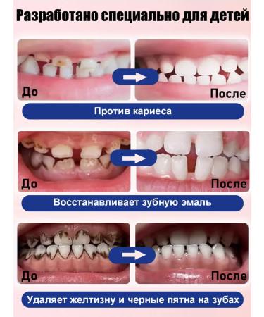 BigHeaded Bird Children's toothpaste with fluorine Home teeth whitening - Buy Online on GoSupps.com