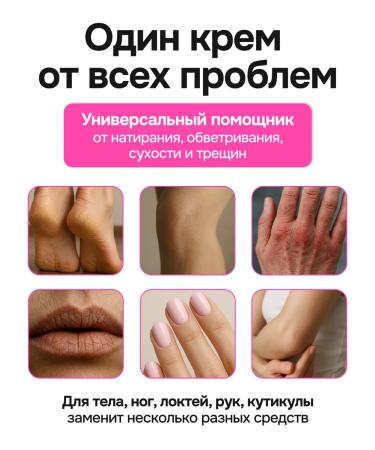 SILVERSTICK Nourishing cream for hands and heels from cracks - Buy Online on GoSupps.com