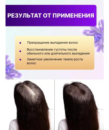 PANPHARMA BIOTIN 10 000 hair vitamins - Buy Online on GoSupps.com