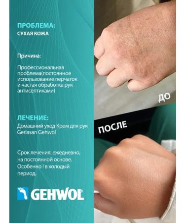 Gehwol Gerlasan hand cream is nutritious and softening 75 ml - Buy Online on GoSupps.com