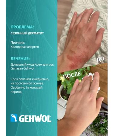 Gehwol Gerlasan hand cream is nutritious and softening 75 ml - Buy Online on GoSupps.com