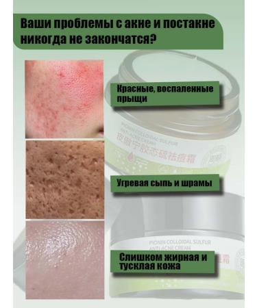 LYDIMOON Cream against acne 30g - Buy Online on GoSupps.com