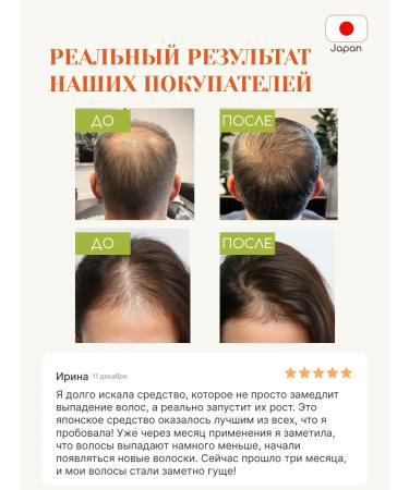 Tokishi LC Hair growth with rosemary - Buy Online on GoSupps.com