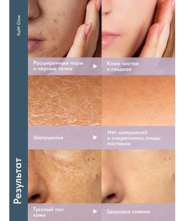 KaMaGlow Enzyme powder for washing peeling - Buy Online on GoSupps.com