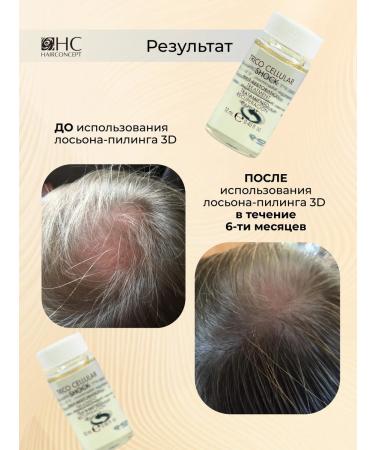 HAIRCONCEPT 3D growth set for hair growth 6pcs - Buy Online on GoSupps.com