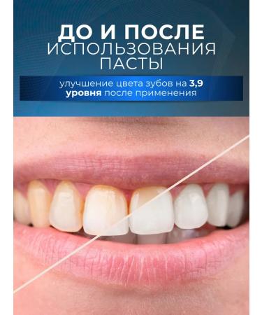 Toothpaste whitening with probiotic enzymes - Buy Online on GoSupps.com