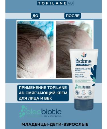 Biolane Mitigating facial cream and age emolet from birth 50ml - Buy Online on GoSupps.com
