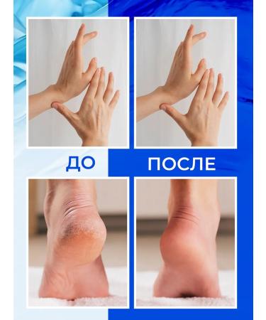 Healthy & Beauty Project Hands legs and body moisturizing with urea 20 % - Buy Online on GoSupps.com