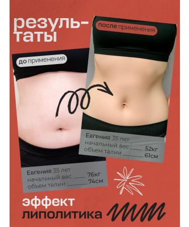 VIS MEDICUS PHARM Lighting capsules Fat -burner - Buy Online on GoSupps.com