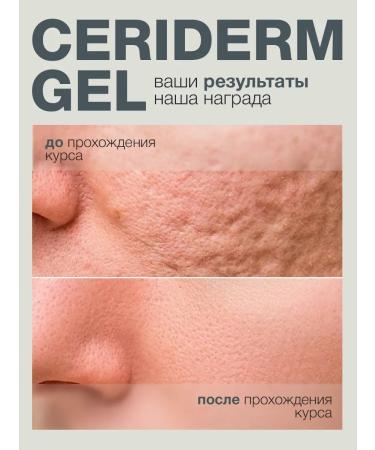 VIS MEDICUS Cream from scars and scars - Buy Online on GoSupps.com