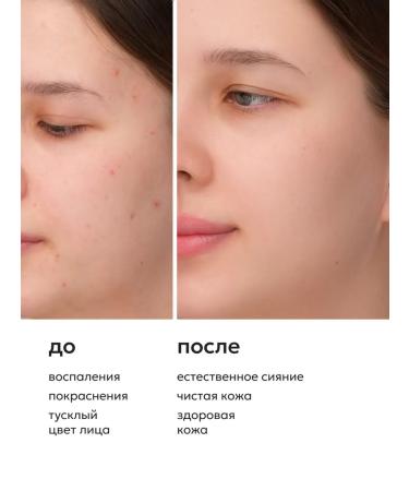 Likato professional Foam for washing a face with support for a microbioma 160 ml - Buy Online on GoSupps.com