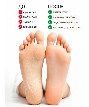 TUZ Cream for body arms and legs 15 in 1 with urea 20 % - Buy Online on GoSupps.com