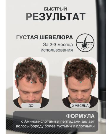 Seira Hair growth and hair loss on the head - Buy Online on GoSupps.com