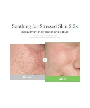 Medicube EXOSOME Cica Cream Restored Cream - Buy Online on GoSupps.com