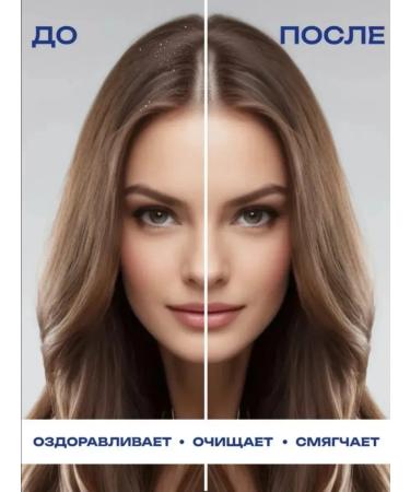 Clear Vita Abe Romania Hair loss - Buy Online on GoSupps.com