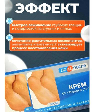 Feet cream from cracks in the feet of 150 ml - Buy Online on GoSupps.com