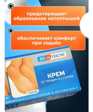 Feet cream from cracks in the feet of 150 ml - Buy Online on GoSupps.com