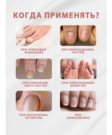 Crimean healer Ointment from nail fungus - Buy Online on GoSupps.com