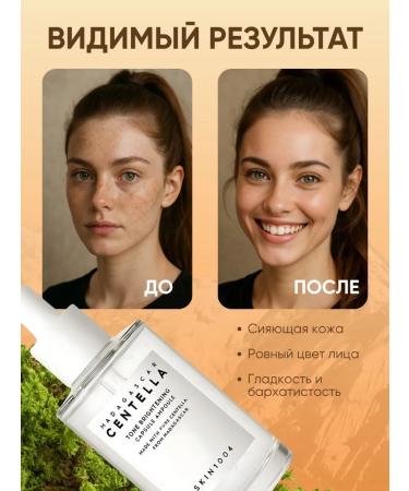 SKIN 1004 Centella Brightening ampoule clarifying face - Buy Online on GoSupps.com