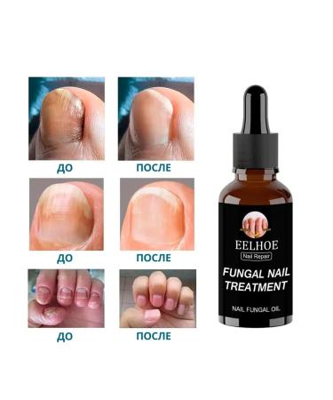 Treatment of nail fungus recovery panthenol glycerin - Buy Online on GoSupps.com
