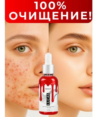 LUCAS PREMIUM LC Multi -word face peeling with apple acid