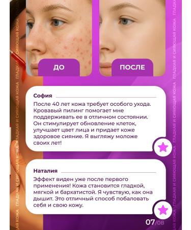 LUCAS PREMIUM LC Multi -word face peeling with apple acid - Buy Online on GoSupps.com