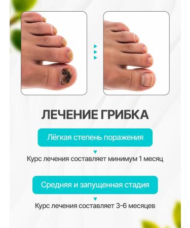 TwinGreen Thai ointment from psoriasis eczema and nail fungus - Buy Online on GoSupps.com