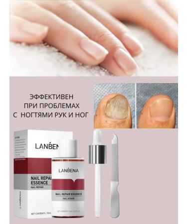 KUDASH Remedy for toenail fungus - Buy Online on GoSupps.com