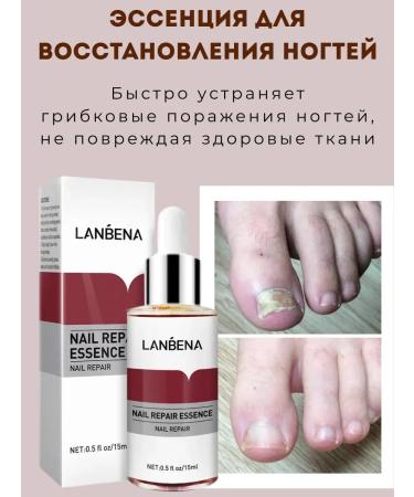 KUDASH Remedy for toenail fungus - Buy Online on GoSupps.com