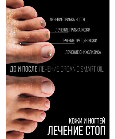 Smart Master Organic oil smart oil monarchy oil from onycholysis - Buy Online on GoSupps.com