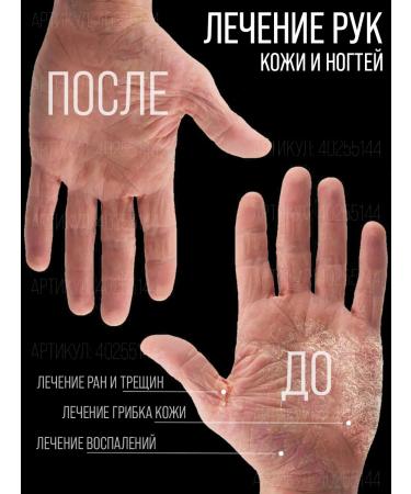 Smart Master Organic oil smart oil monarchy oil from onycholysis - Buy Online on GoSupps.com