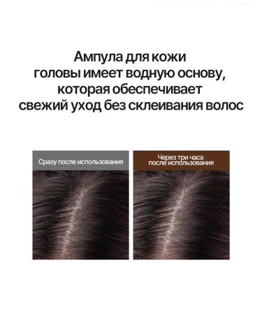 Su Organic Serum from falling out and for hair growth 10 ml - Buy Online on GoSupps.com