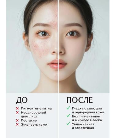Anua Facial hen of the face with niacinamide 10% Korea - Buy Online on GoSupps.com