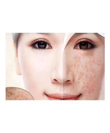 MartiDerm SPF 50+ DSP-Crema FPS 50+ 40 ml cream - Buy Online on GoSupps.com