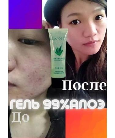 YUNNIU Moisturizing aloe gel for dry skin for the face For burns For skin restoration - Buy Online on GoSupps.com