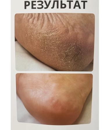 Vitex Salt bath concentrate paraffin therapy - Buy Online on GoSupps.com