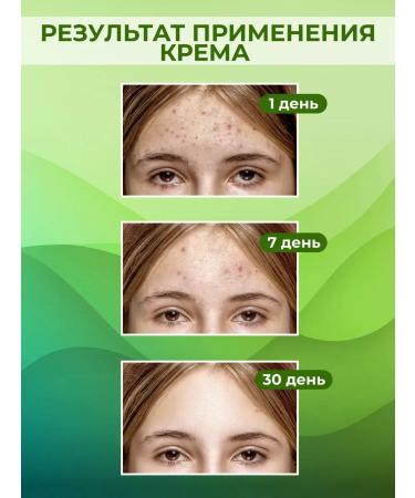 SALE Acne cream - acne and acne on the face and body - Buy Online on GoSupps.com