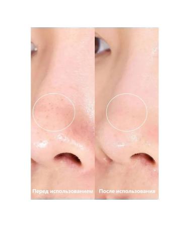 ILSO softening agent for the sebaceous glands 150 ml 3pcs - Buy Online on GoSupps.com