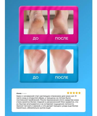 lvcos premium Moisturizer with urea - Buy Online on GoSupps.com