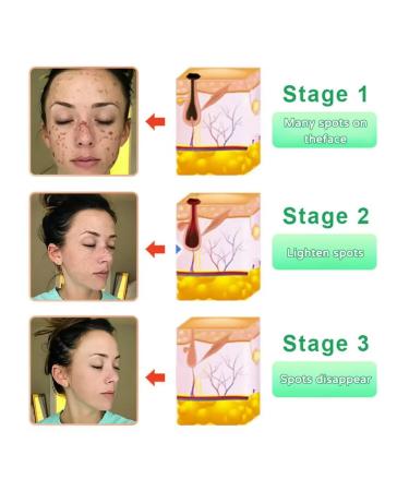 Gel for cleaning pores and peeling 50g - Buy Online on GoSupps.com