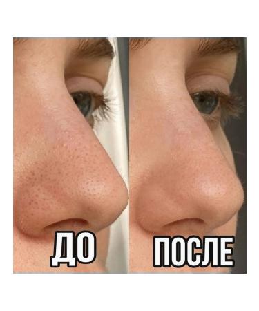 Ciracle Blackhead Off black dots mask set 20 pcs - Buy Online on GoSupps.com