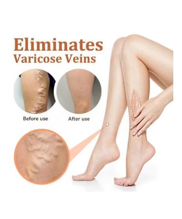 Body scrub from varicose veins (100 ml of exfoliation) - Buy Online on GoSupps.com