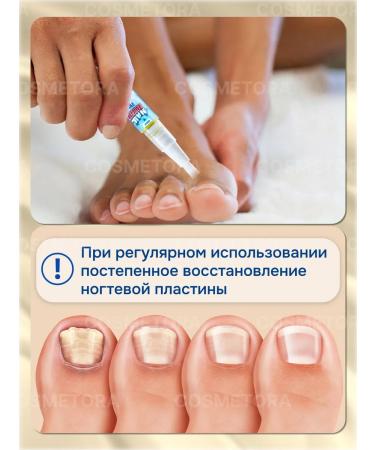 100% Original Pencil from nail fungus - Buy Online on GoSupps.com