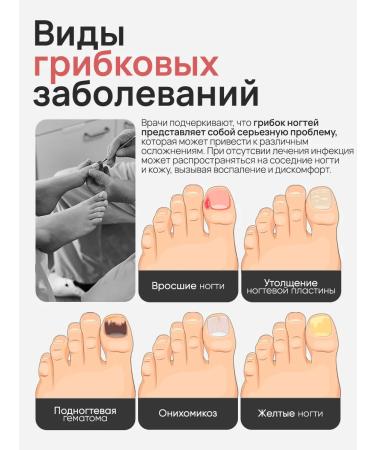 balace Mykored Forte Remedy for nail fungus and cracks - Buy Online on GoSupps.com